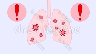 一个人的肺部和呼吸系统中的Covid-19或皇冠病毒的动画。 病毒的传播